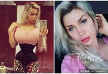 打掉6肋骨造纖腰!「潔西卡兔子」女整容19次:眼珠變綠了-博狗扑克 蜗牛扑克 德州扑克跟我学