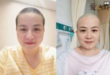 【EV扑克】岳云鹏老婆回应生病剃光头! 她得了什么病身体现状如何-博狗扑克 蜗牛扑克 德州扑克跟我学