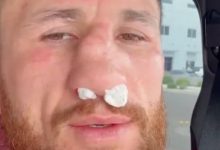 梅拉布·德瓦利什维利鼻骨两处骨折仍要打!放话硬刚亨利·塞胡多,大发体育助力你的致富之路!-博狗扑克 蜗牛扑克 德州扑克跟我学