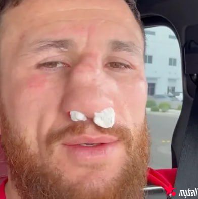 梅拉布·德瓦利什维利鼻骨两处骨折仍要打!放话硬刚亨利·塞胡多,大发体育助力你的致富之路!